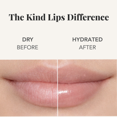 Kind Lips Organic Lip Balm Variety 3 Pack | Multiple Flavors | Made in USA